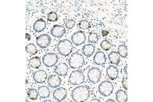 Immunohistochemistry (Paraffin-embedded Sections) (IHC (p)) image for anti-Eukaryotic Translation Initiation Factor 2, Subunit 2 Beta, 38kDa (EIF2S2) antibody (ABIN7073880)