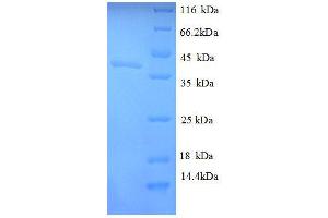 Ornithine Carbamoyltransferase, Chain F Protein (ARGF) (AA 2-334), (full length) protein (His tag)