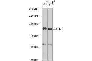 Western blot analysis of extracts of various cell lines, using XRN2 antibody (ABIN7265345) at 1:1000 dilution. (XRN2 Antikörper)
