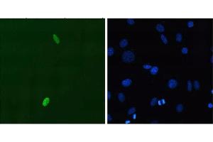 Immunofluorescent staining using P2B1 mouse monoclonal anti-DUX4 N-terminus on C2C12 myoblasts transfected with pCS2+DUX4. (DUX4 Antikörper)