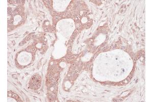 Immunohistochemistry (IHC) image for anti-Sequestosome 1 (SQSTM1) (AA 325-375) antibody (ABIN7454876) (SQSTM1 Antikörper  (AA 325-375))