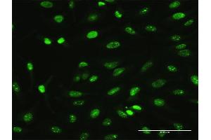 Immunofluorescence of monoclonal antibody to MAGEA2 on HeLa cell. (MAGEA2 Antikörper  (AA 1-314))