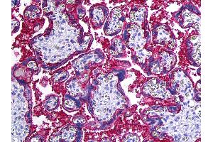 Anti-CD46 antibody IHC of human placenta. (CD46 Antikörper)