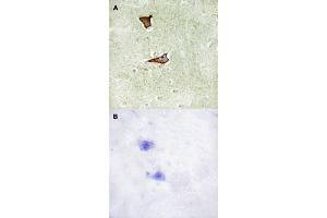 Immunohistochemical staining (Formalin-fixed paraffin-embedded sections) of human brain tissue with IGF2R (phospho S2409) polyclonal antibody  without blocking peptide (A) or preincubated with blocking peptide (B) under 1:50-1:100 dilution. (IGF2R Antikörper  (pSer2409))
