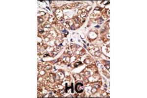 Image no. 1 for anti-Neuronal Differentiation 1 (NEUROD1) (AA 15-45) antibody (ABIN2451575) (NEUROD1 Antikörper  (AA 15-45))