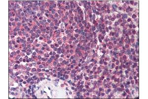 Human Spleen (formalin-fixed, paraffin-embedded) stained with HNF4Aat 2 µg/ml followed by biotinylated anti-goat IgG secondary antibody, alkaline phosphatase-streptavidin and chromogen. (HNF4A Antikörper  (N-Term))