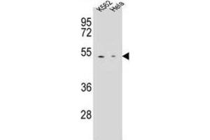 Western Blotting (WB) image for anti-Carboxypeptidase B1 (Tissue) (CPB1) antibody (ABIN2996494) (CPB1 Antikörper)