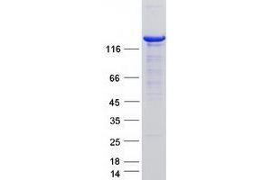 Western Blotting (WB) image for Ubiquitin Specific Peptidase 8 (USP8) (Transcript Variant 1) protein (Myc-DYKDDDDK Tag) (ABIN2735145)