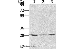 Western blot analysis of A375, hela and A172 cell, using HSD17B12 Polyclonal Antibody at dilution of 1:570 (HSD17B12 Antikörper)
