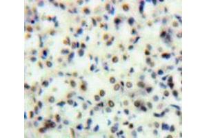 Used in DAB staining on fromalin fixed paraffin-embedded Kidney tissue (TOP2 Antikörper  (AA 749-987))