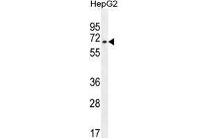 ZNF860 Antibody (C-term) western blot analysis in HepG2 cell line lysates (35 µg/lane). (ZNF860 Antikörper  (C-Term))