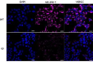 Immunocytochemical staining of HeLa cells using NDUFB11 antibody (ABIN7799549), 1:1,000), Top panel: wild-type (WT), Bottom panal: NDUFB11 shRNA knockdown (KD). (NDUFB11 Antikörper)