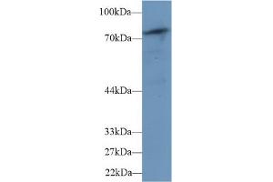 Western blot analysis of Mouse Skeletal muscle lysate, using Human PLCd4 Antibody (1 µg/ml) and HRP-conjugated Goat Anti-Rabbit antibody ( (PLCD4 Antikörper  (AA 1-250))