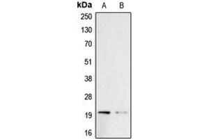Western blot analysis of Probetacellulin expression in A431 (A), PC3 (B) whole cell lysates. (Betacellulin Antikörper  (Center))
