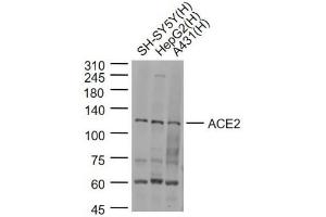 Lane 1: SH-SY5Y cell lysates; Lane 2: HepG2 cell lysates; Lane 3: A431 cell lysates probed with ACE2 Polyclonal Antibody, Unconjugated (bs-23443R) at 1:1000 dilution and 4˚C overnight incubation. (ACE2 Antikörper  (AA 451-550))