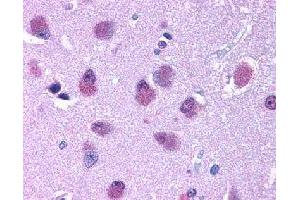 Immunohistochemical (Formalin/PFA-fixed paraffin-embedded sections) staining in human brain with BRS3 polyclonal antibody . (BRS3 Antikörper)