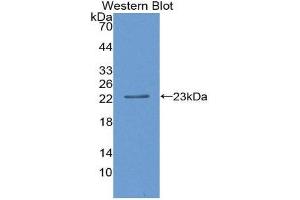 Western Blotting (WB) image for anti-SIVA1, Apoptosis-Inducing Factor (SIVA1) (AA 1-175) antibody (ABIN3202187) (SIVA1 Antikörper  (AA 1-175))