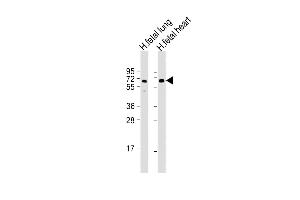 All lanes : Anti-ALG6 Antibody (Center) at 1:2000 dilution Lane 1: human fetal lung lysate Lane 2: human fetal heart lysate Lysates/proteins at 20 μg per lane. (ALG6 Antikörper  (AA 241-274))