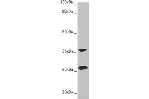Western blot All lanes: RAB12 antibody at 2 μg/mL + Hela whole cell lysate Secondary Goat polyclonal to rabbit IgG at 1/10000 dilution Predicted band size: 28 kDa Observed band size: 28, 36 kDa (RAB12 Antikörper  (AA 98-241))