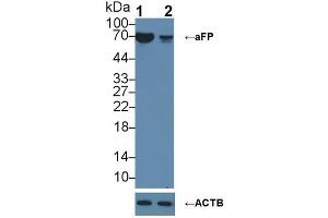 Knockout Varification: ;Lane 1: Wild-type HepG2 cell lysate; ;Lane 2: aFP knockout HepG2 cell lysate; ;Predicted MW: 69kDa ;Observed MW: 69kDa;Primary Ab: 2µg/ml Rabbit Anti-Human aFP Antibody;Second Ab: 0. (alpha Fetoprotein Antikörper  (AA 31-576))