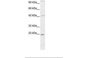 Image no. 2 for anti-High Mobility Group Box 2 (HMGB2) (C-Term) antibody (ABIN6735776) (HMGB2 Antikörper  (C-Term))