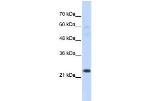 Western Blotting (WB) image for anti-TAF12 RNA Polymerase II, TATA Box Binding Protein (TBP)-Associated Factor, 20kDa (TAF12) (N-Term) antibody (ABIN2792680)