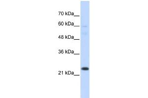 WB Suggested Anti-TAF12 Antibody Titration:  0. (TAF12 Antikörper  (N-Term))