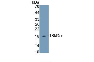 Detection of Recombinant HBEGF, Human using Monoclonal Antibody to Heparin Binding Epidermal Growth Factor Like Growth Factor (HBEGF) (HBEGF Antikörper  (AA 21-160))