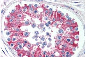 Human Testis (formalin-fixed, paraffin-embedded) stained with SMAD6 antibody ABIN295868 at 5 ug/ml followed by biotinylated goat anti-rabbit IgG secondary antibody ABIN481713, alkaline phosphatase-streptavidin and chromogen. (SMAD6 Antikörper  (AA 85-99))