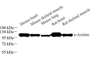 Western blot analysis of Sarcomeric α Actinin (ABIN7075510) at dilution of 1: 1000 (Sarcomeric alpha Actinin Antikörper)