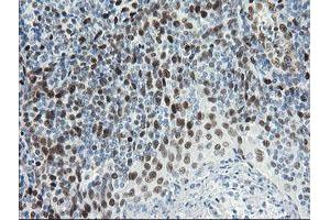 Image no. 13 for anti-Transducin-Like Enhancer of Split 1 (E(sp1) Homolog, Drosophila) (TLE1) (AA 180-460) antibody (ABIN1491049)