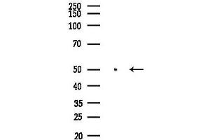 Western blot analysis of lysates from Rat kidney, using PPAR alpha Antibody at 1/1000 dilution.