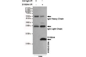 Immunoprecipitation analysis of Hela cell lysates using S100A4 mouse mAb. (s100a4 Antikörper)