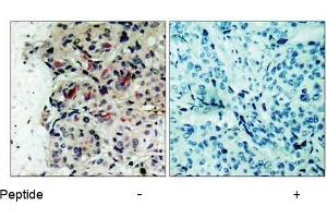 Image no. 1 for anti-Janus Kinase 1 (JAK1) (Tyr1022) antibody (ABIN197301) (JAK1 Antikörper  (Tyr1022))