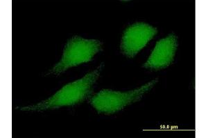Immunofluorescence of purified MaxPab antibody to RBX1 on HeLa cell.