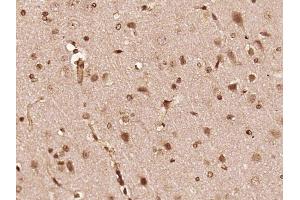 Paraformaldehyde-fixed, paraffin embedded rat brain, Antigen retrieval by boiling in sodium citrate buffer (pH6) for 15min, Block endogenous peroxidase by 3% hydrogen peroxide for 30 minutes,  Blocking buffer (normal goat serum) at 37°C for 20min, Antibody incubation with FGFR1/FGFR2 (Tyr463/Tyr466) Antibody (bs-5326R) at 1:400 overnight at 4°C, followed by a conjugated secondary and DAB staining. (FGFR1/FGFR2 Antikörper  (pTyr463, pTyr466))