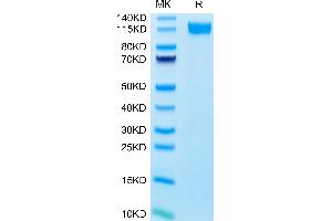 Human E-selectin on Tris-Bis PAGE under reduced conditions. (Selectin E/CD62e Protein (AA 22-556) (Fc Tag))