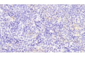 Detection of GM-CSF in Mouse Spleen Tissue using Polyclonal Antibody to Colony Stimulating Factor 2, Granulocyte Macrophage (GM-CSF) (GM-CSF Antikörper  (AA 19-141))