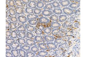 ABIN6255266 and ABIN6277952 at 1/100 staining Rat colon tissue by IHC-P.