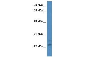 Western Blot showing CBR4 antibody used at a concentration of 1-2 ug/ml to detect its target protein. (CBR4 Antikörper  (N-Term))