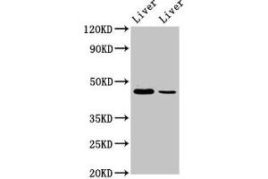 Western Blot Positive WB detected in: Mouse liver tissue, Rat liver tissue All lanes: DDB2 antibody at 4. (DDB2 Antikörper  (AA 1-185))