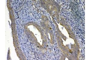 Immunohistochemistry (IHC) image for anti-UDP Glucuronosyltransferase 1 Family, Polypeptide A1 (UGT1A1) antibody (ABIN5708492)