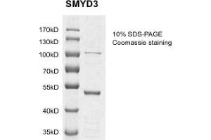 Recombinant SMYD3 protein gel.