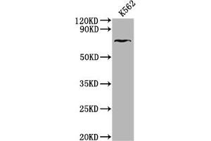 Western Blot Positive WB detected in: K562 whole cell lysate All lanes: HHIP antibody at 1:2000 Secondary Goat polyclonal to rabbit IgG at 1/50000 dilution Predicted band size: 79, 37 kDa Observed band size: 79 kDa (HHIP Antikörper  (AA 183-424))