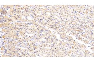 Detection of LAMa2 in Mouse Stomach Tissue using Polyclonal Antibody to Laminin Alpha 2 (LAMa2) (Laminin Antikörper  (AA 2901-3106))