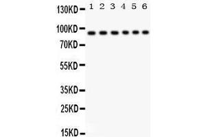 Western Blotting (WB) image for anti-Signal Transducer and Activator of Transcription 3 (Acute-Phase Response Factor) (STAT3) (AA 139-167), (N-Term) antibody (ABIN3043299)