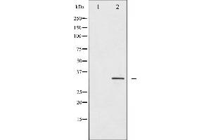 Western blot analysis of IGFBP-3 expression in HuvEc whole cell lysates,The lane on the left is treated with the antigen-specific peptide. (IGFBP3 Antikörper  (Internal Region))