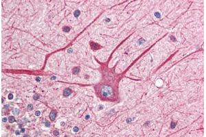 Human Brain, Cerebellum (formalin-fixed, paraffin-embedded) stained with EIF2AK2 antibody ABIN214488 at 2. (EIF2AK2 Antikörper  (C-Term))