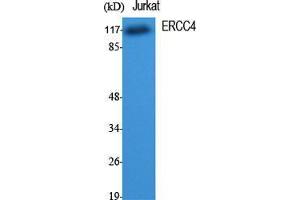 Western Blot (WB) analysis of specific cells using ERCC4 Polyclonal Antibody. (ERCC4 Antikörper  (C-Term))