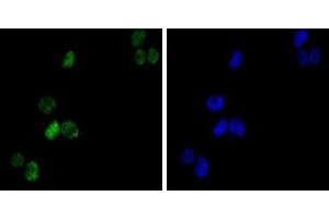 Immunofluorescence analysis of K562(left) cells using GATA1 mouse mAb (green).